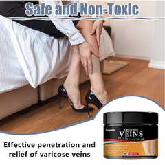 Hyggear Crema para Varices - Tratamiento de Alivio Natural para Piernas, Arañas Vasculares y Fortalecer la Salud Capilar